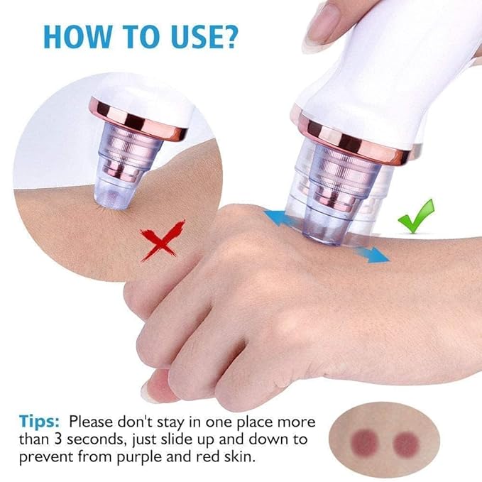 "GlowSkin™ Portable Blackhead Remover"