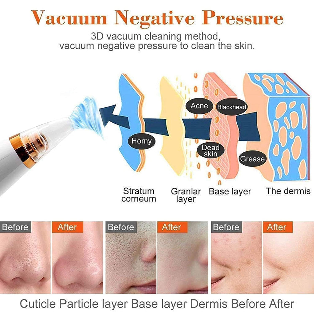 "GlowSkin™ Portable Blackhead Remover"