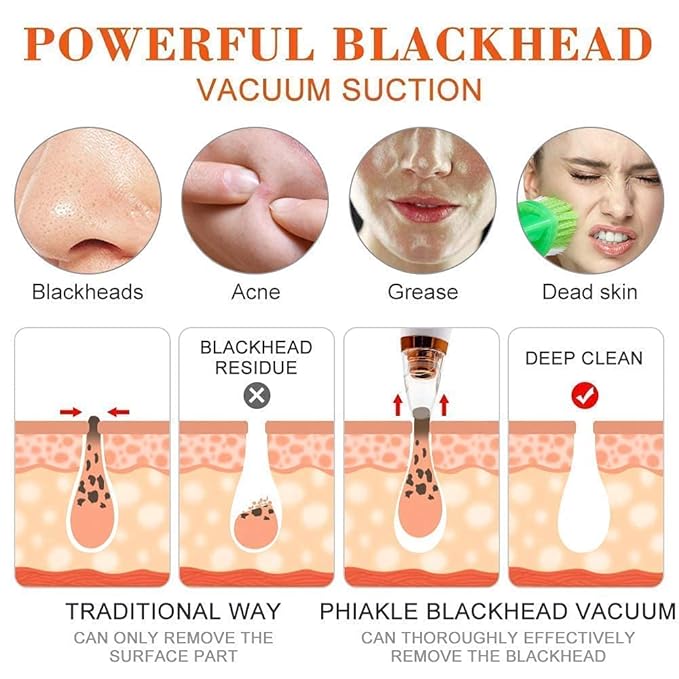"GlowSkin™ Portable Blackhead Remover"